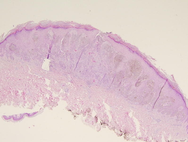 Pathology Image